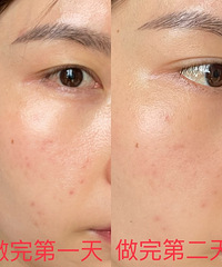 ���м��ַ�������������̫�����ˣ������ȥ��ҽԺ