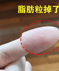 实验了一周终于有成效!我终于知道怎么去脂肪粒了