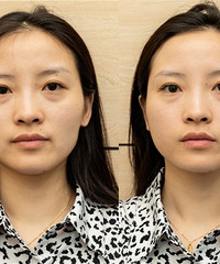 �����沿���ݵ�ͯ���룬����һ���ӡ��ء�������