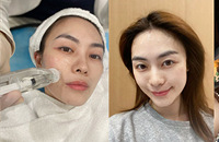 35+的我也来试试这个高效补水项目
