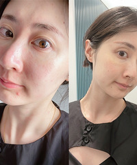 ����pp������Ƥ�Ľ��ý������ڰ�������ȥ��Ѫ˿�����ճ��ˣ�