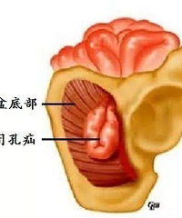 你听说哪些真实的罕见病?