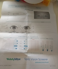 三岁孩子都没怎么看电子产品,左右眼检查都有问题