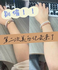 ���׼�¼�������ˣ�40�����ֱ۱��һ����