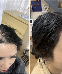 ��С����ͷ���ķ������ڽ����  ���ڳ�����ͷ��