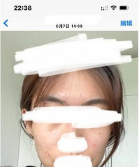 倩碧镭射你真的有点东西!分享我从5月份到现在的痘印变化