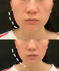 30+���������Ҫ��ҽ��������������ȥ������������������ᣡ