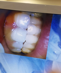 ϴ����֪���Լ����ж��࣬20��ͷ���Ҿ�Ȼ��������ʯ��