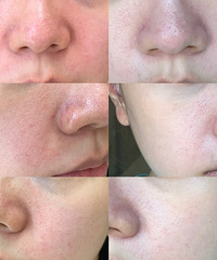 Ƥ���������췢�ȹ����������ȵ�ҽ����Ŀ��ֻ����һ������