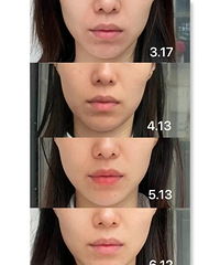 �沿�٤�ĸ��� �Ա�ͼ