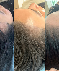 ��ȡë�Ҳ�ֲ���������������µ�����Ч����