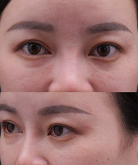 Ҫ����������Ȧ���ṵ��������������è��