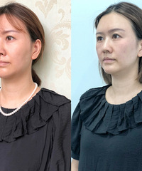 ֻ��5999���ܳа���һ��Ŀ�˥��Ŀ��������������Ͳ������