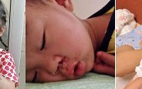 孩子一周流鼻血4、5次,甚至半夜睡觉流一枕头