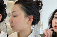 想要美白提亮、祛红血丝,试试这个项目