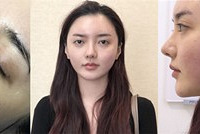 一次性就能达到“美肤+瘦脸”的超棒效果