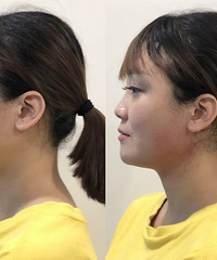 ����ݶ��ӵķ���̫���˰ɣ�1Сʱ��ΧС��5cm�����߶�������