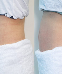 ����ݶ��ӵķ���̫���˰ɣ�1Сʱ��ΧС��5cm�����߶�������