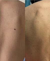 �ײ����õ���ǰ�غ󱳶����ĺ������