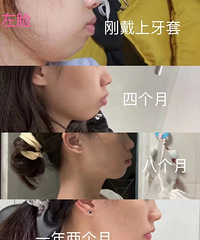 ���ž������������壬���ﱻҽ�����Ǳ仯�������һ��