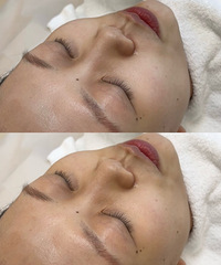 ��Ƥ���õĸ�����AOPT���������㲻ֹ��һ����