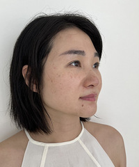 ÿ��Ů�˶��к�Ѫ˿��ë�״ִ����š���̸����ҽ�����ƺ�Ѫ˿����