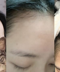 史上最全最真实的秃头女孩生发经验分享!还有发型神器安利