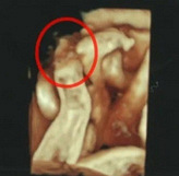 ҽ����û���ֺ��ӻ���