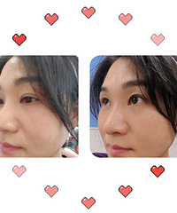 ������ˮ����������������˿�����¶Ա�