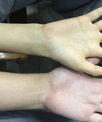 ��Ѫ�㲻�����ǲ�һ����������һЩС����