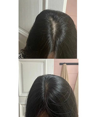 ����ͷ��50�죬���ͷ���������ٶȷǳ���