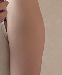 �ֱ�̫�����д���У����ﶼ�Ǵ�Ҿ�����Ч�����ֱ۷�����������