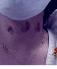 ������110�����ⰸ���������ס