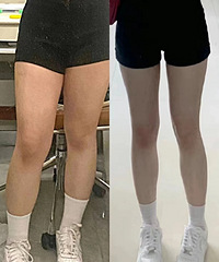 �������������ȣ����Ѿ�˵����