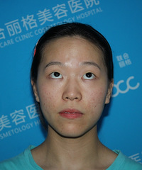 ˫��Ƥ�ռǷ�����û�в���