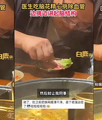 医生吃火锅用牙签剔除脑花血管
