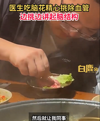 医生吃火锅用牙签剔除脑花血管