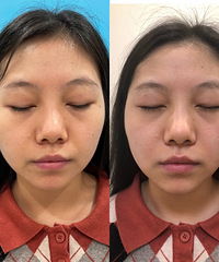 �ڻ���ǰȥ�����˴������ᣬЧ�����ԣ�����ױʦ������Ƥ��״̬��