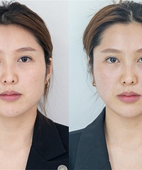 ��������������ѡ��˥������������Plus����ʹ������кܺ�