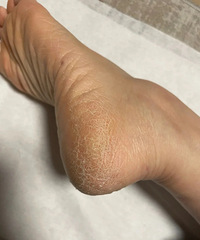 ����Ұ���һ����������Ҫ��Խź���ֲڸ��ѣ���ĺ�����