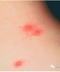 ׶Ƥȫɺ