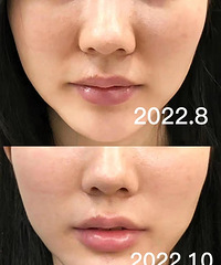 �������Ƶĵ�62�죬Ч����ĺ�����