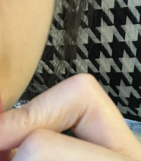 �����кܶ����ײ���Ч�����ƿ�ǻ����ĺ÷����������ղر���