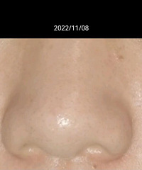 ȥ��ͷȡ��С�׶���ʤ����������̳���õİ�������