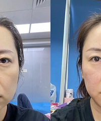 �����̥���Ҹ��ܵ��ˣ���˥����Ҫ�ԣ����������������