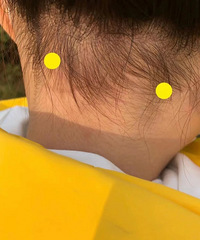 �ѷ��������Ѩλ �� �� �� ����