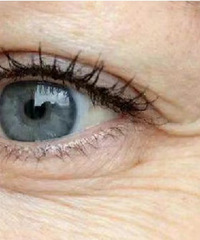 �������̫�����ˣ���û���ܹ�ȥ�����Ƶķ�����ҽ��Ҳ�У�