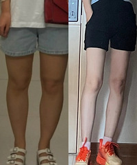 ������Զ���ż�Ъ������������Ч����ľ���