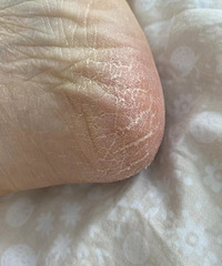 ��Ľź��Ҳ�����ָ��ֲ���������ķ������ô�ɽű�úܻ���