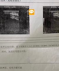 ӱó淴ҧһ˿ڣû뵽صҪ